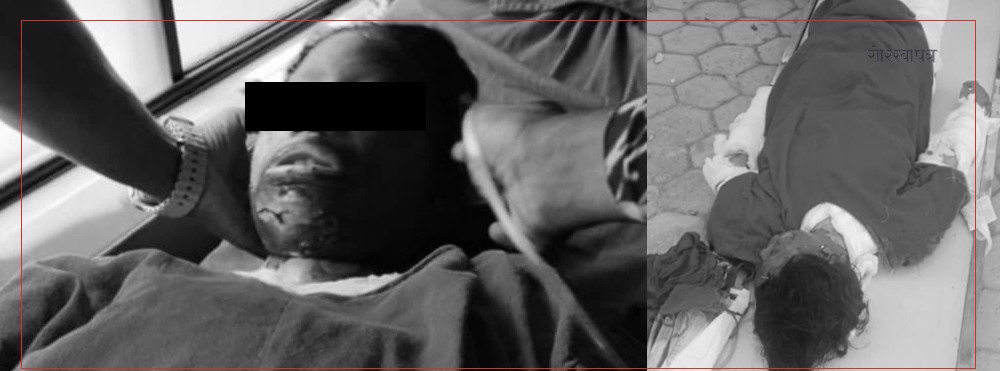 शुद्धोधन गाउँपालिकामा ग्यास सिलिन्डर लिक भई आगलागी, दाजु-बहिनीको मृत्यु